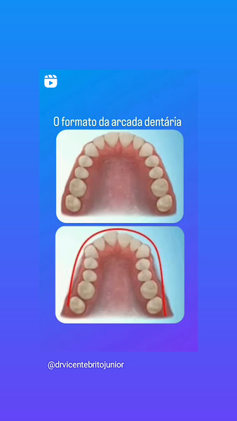 Foto 3 de Dr Vicente Brito Jr - Ortodontia - Aparelhos dentários