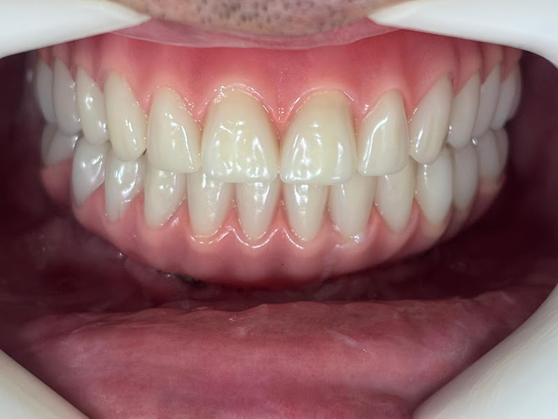 Foto 3 de Dr Victor Lopes - Consultório odontológico - Especialista em prótese