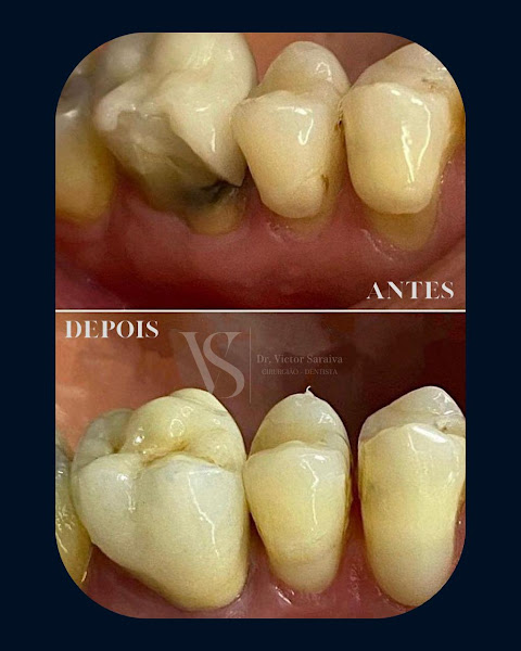 Foto 2 de Dr. Victor Saraiva – Dentista em Ipatinga MG – VS Odontologia Integrada 24h