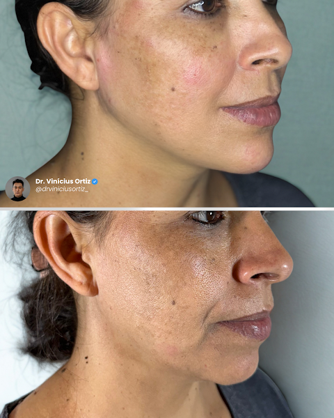 Foto 2 de Dr. Vinícius Ortiz • Harmonização Curitiba