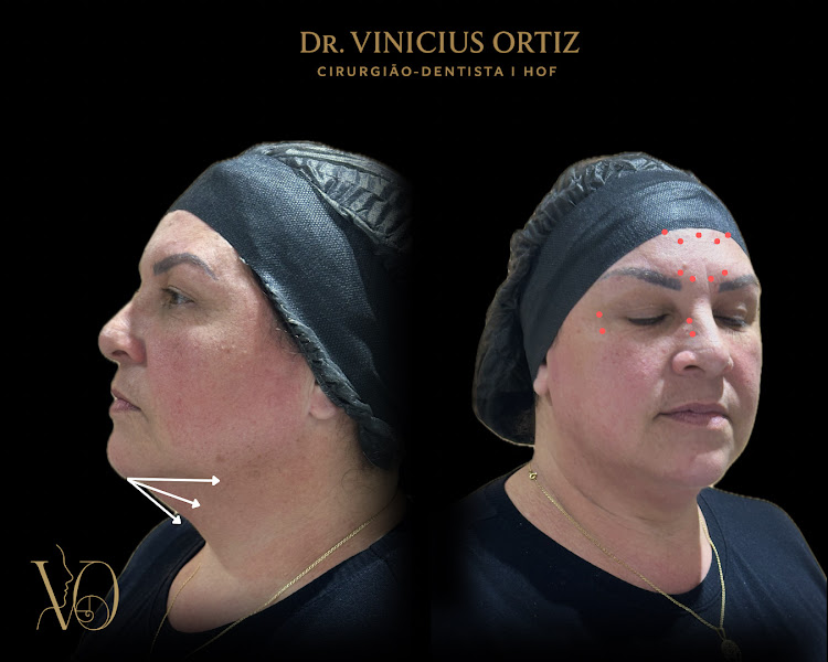 Foto 3 de Dr. Vinícius Ortiz • Harmonização Curitiba