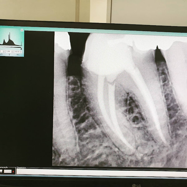 Foto 2 de Dr. Vinícius Ribeiro Odontologia