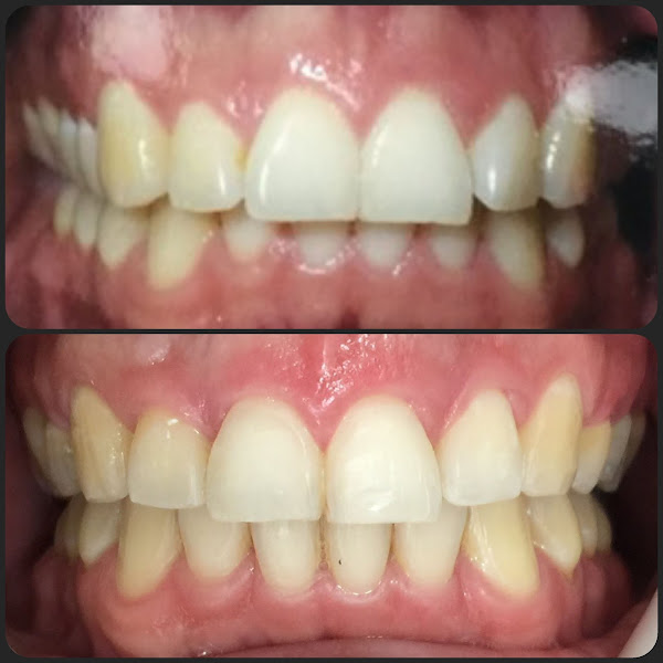 Foto 2 de Dr. Vitor Augusto - Dentista - Ortodontista - Implantodontista - Oral Fix