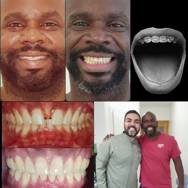 Foto 3 de Dr. Vitor Augusto - Dentista - Ortodontista - Implantodontista - Oral Fix