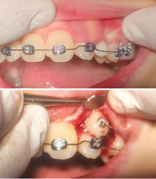 Foto 3 de Dr. Vitor Cesar | Dentista | Campos dos Goytacazes RJ