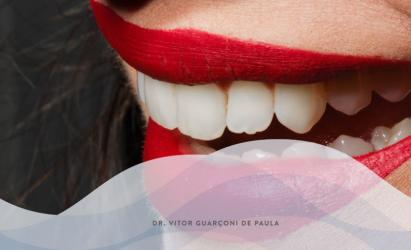 Foto 3 de Dr. Vitor Guarçoni de Paula - Dentista, Especialista, Mestre e Doutor em Prótese Dentária