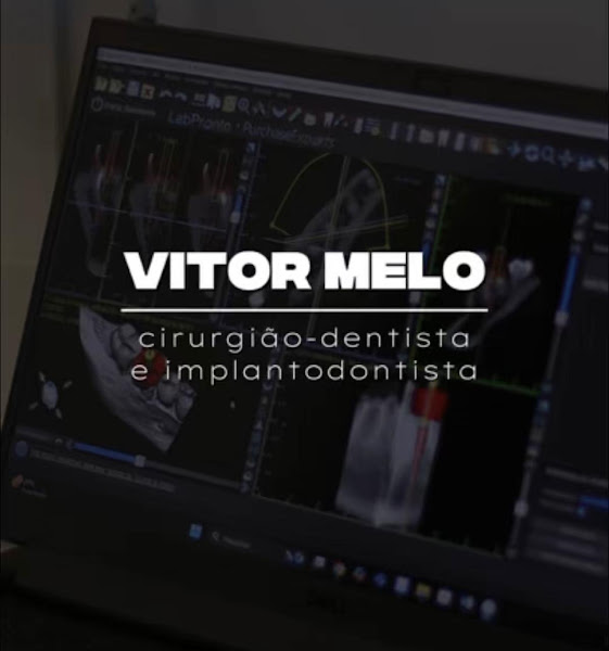Foto 2 de Dr. Vitor Melo - Implantodontista em Franca-SP