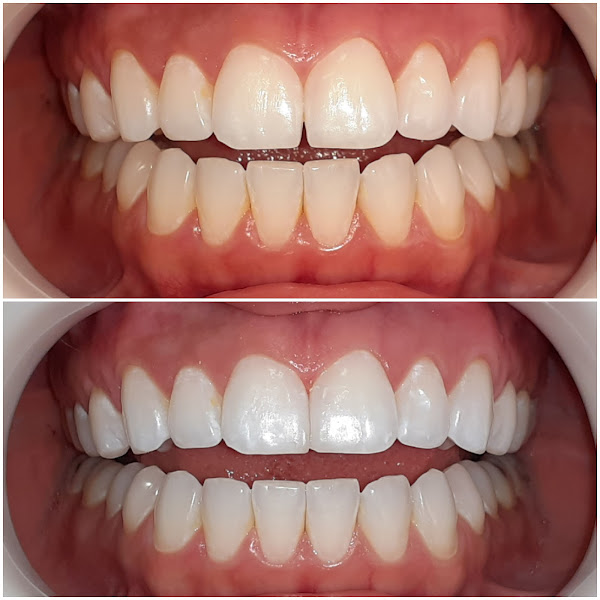 Foto 2 de Dr. Vitor Vieira Cândido