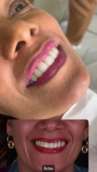 Foto 3 de Dr Wagner Moreira - IMPLANTES DENTARIOS