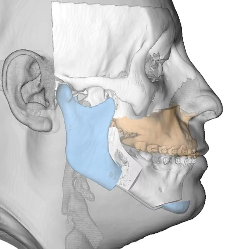 Foto 3 de Dr. Wesley Viana - Cirurgião Bucomaxilofacial