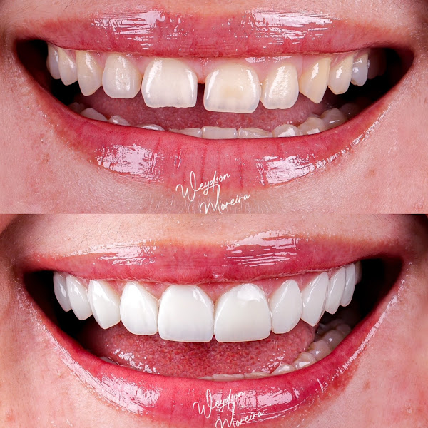 Foto 3 de Dr. Weydson Moreira - Clínica Odontológica