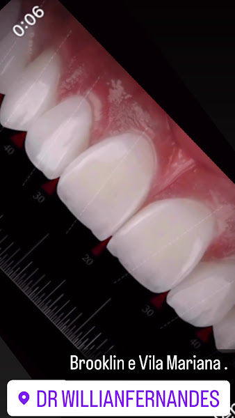 Foto 4 de Dr. Willian Fernandes | Dentista | Brooklin SP