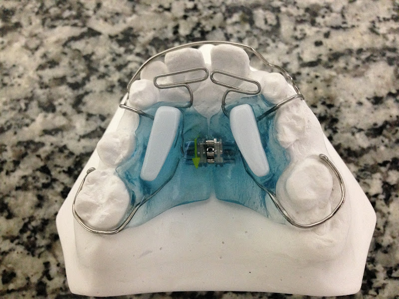 Foto 3 de Dr Willian Guimarães Madeira - Consultório Odontológico