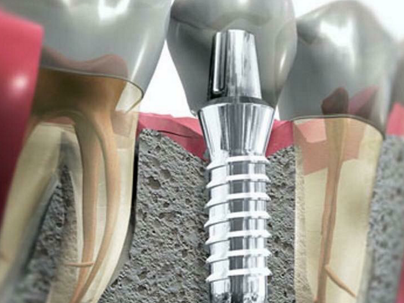 Foto 2 de Dr. Wilson Gaspar Cabral Jr. Cirurgião Dentista