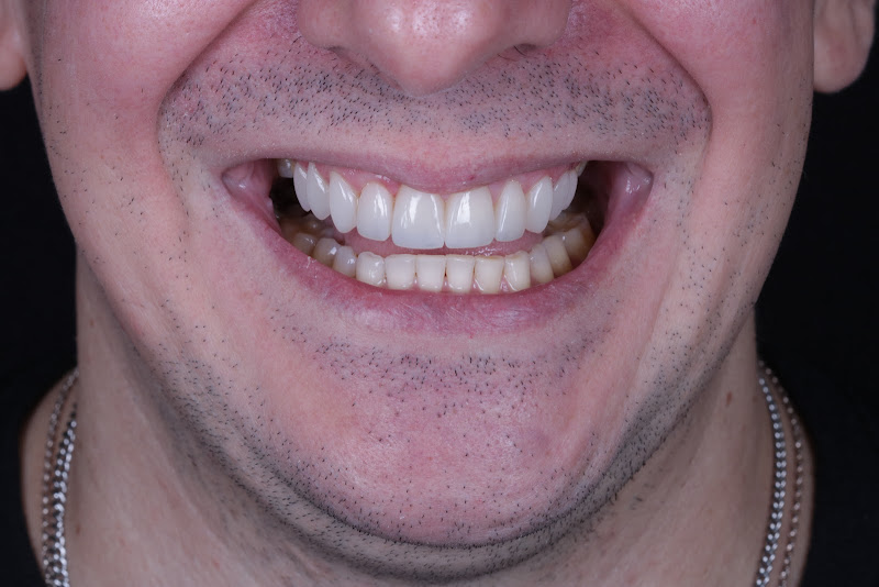 Foto 2 de Dr. Yuri Arbex - Odontologia Estética e Restauradora