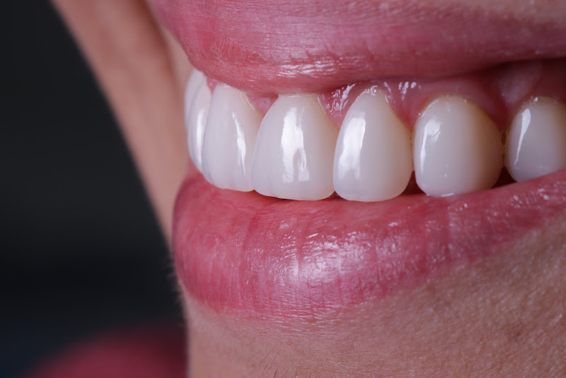 Foto 3 de Dr. Yuri Arbex - Odontologia Estética e Restauradora