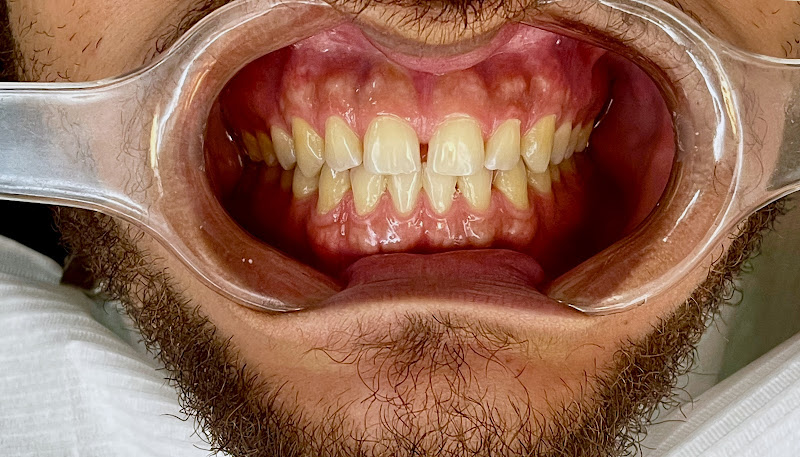 Foto 2 de Dr Yuri Miranda Cirurgião Dentista