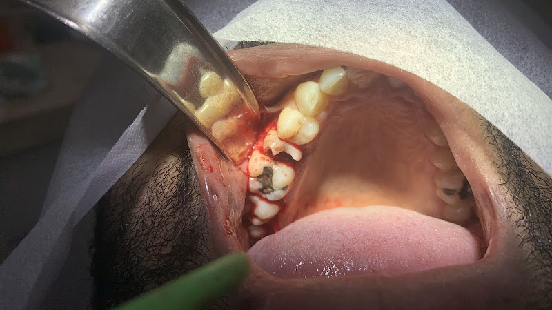 Foto 3 de Dr Yuri Miranda Cirurgião Dentista