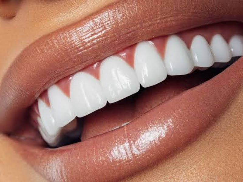 Foto 9 de Dra Adélia Araújo Odontologia Especializada