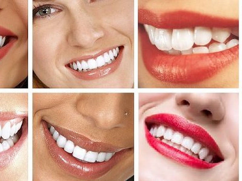 Foto 9 de Dra Adriana Athaide / Cirurgiã Dentista / Zona Norte / Tucuruvi