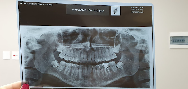 Foto 3 de Dra. Adriana B. M. Rezende - Esp. Buco Maxilo Facial; Cirurgias orais menores; DTM, Dor Orofacial, Bruxismo e Apneia do Sono