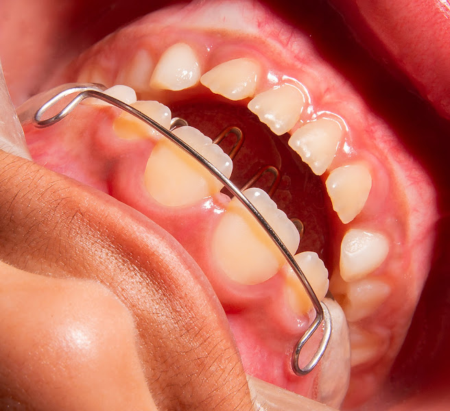 Foto 2 de Dra. Adriana Cezar | Ortodontia