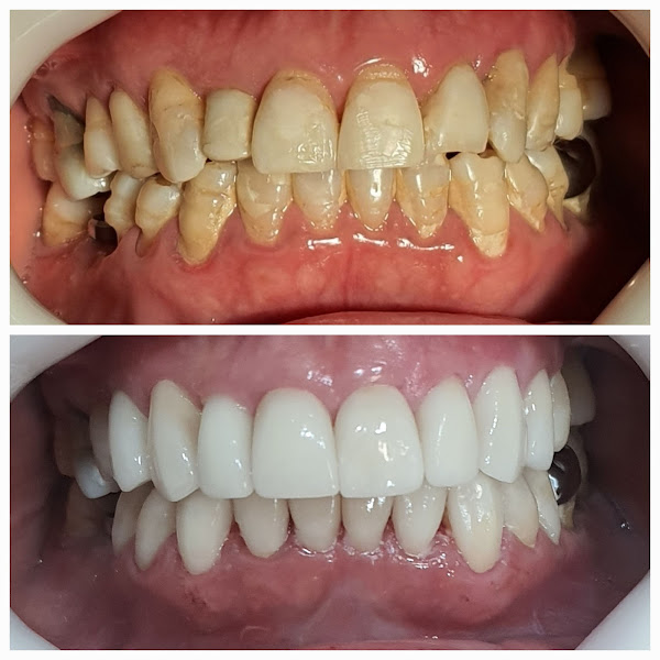 Foto 3 de Dra. Adriana Crudo Odontologia Especializada