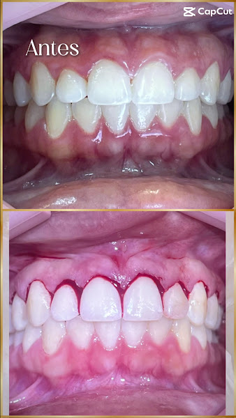 Foto 3 de Dra Adriana Gato Implantes