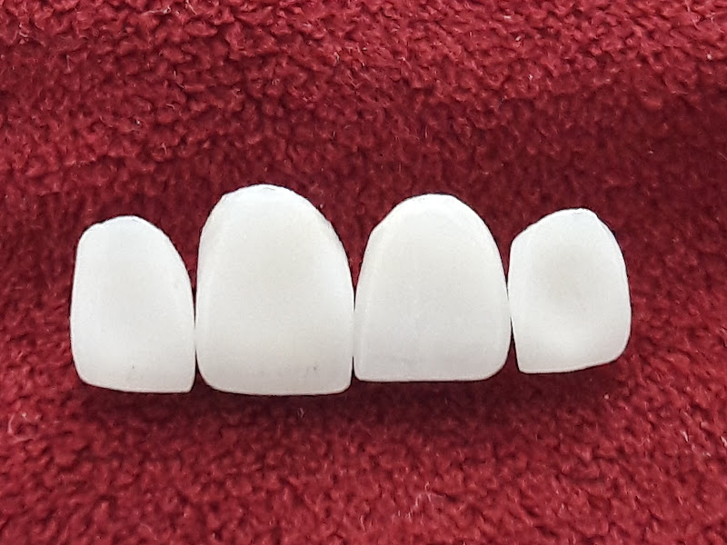 Foto 2 de Dra. Adriana Lima Neri - Dentista Laserterapeuta Negrão de Lima