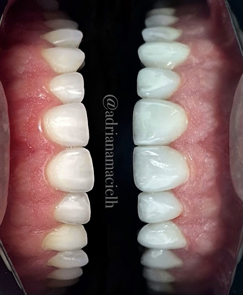 Foto 2 de Dra. Adriana Maciel - Cirurgiã Dentista