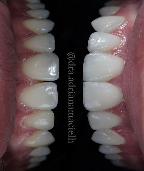 Foto 3 de Dra. Adriana Maciel - Cirurgiã Dentista