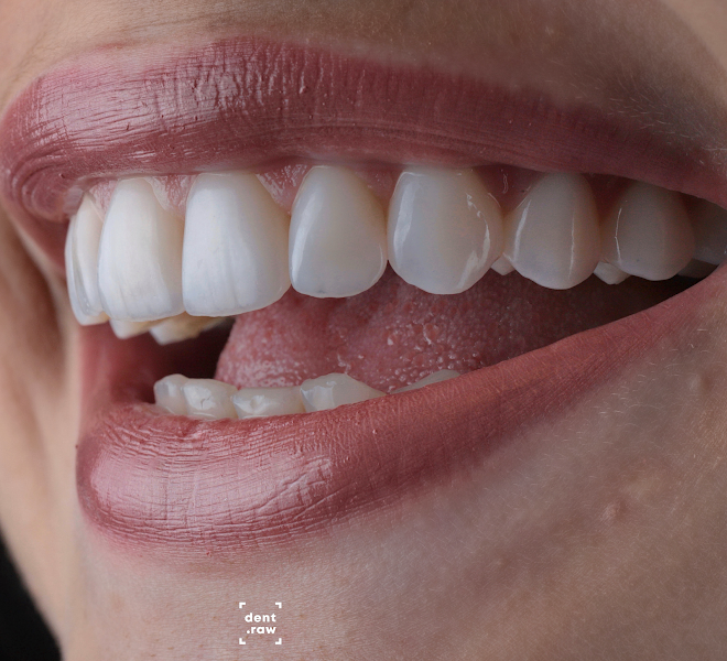 Foto 2 de Dra. Adriana Nascimento - Lentes de Contato Dental Manaus