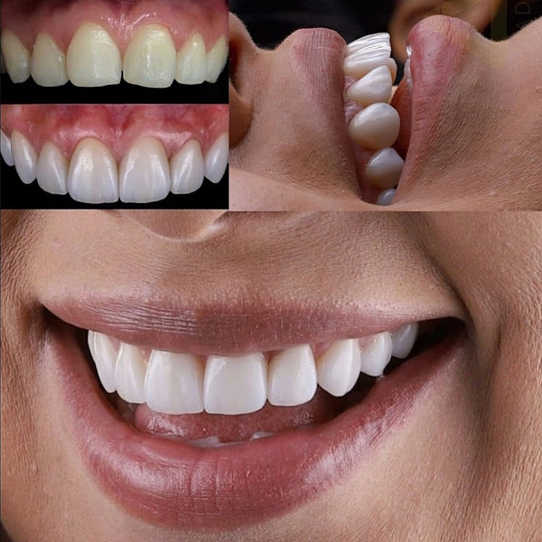 Foto 3 de Dra. Adriana Nascimento - Lentes de Contato Dental Manaus