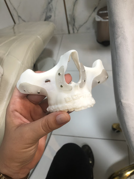 Foto 2 de Dra. Adriana Teles - CIRURGIA E TRAUMATOLOGIA BUCOMAXILO FACIAL