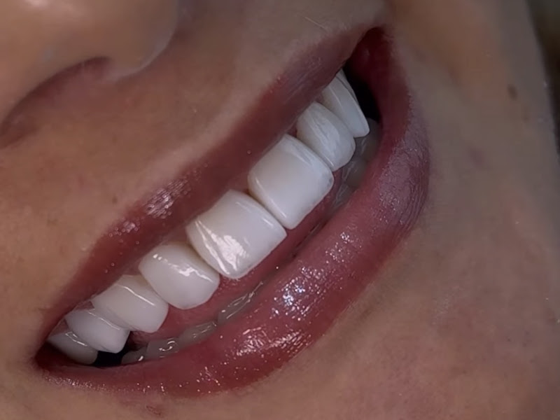 Foto 3 de Dra Adriane Andrade - Lentes e Facetas