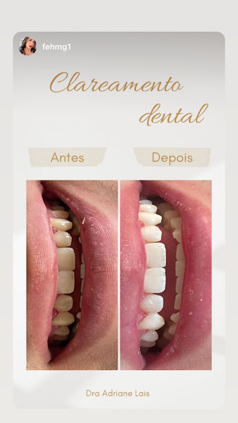 Foto 2 de Dra Adriane Lais - Cirurgiã Dentista