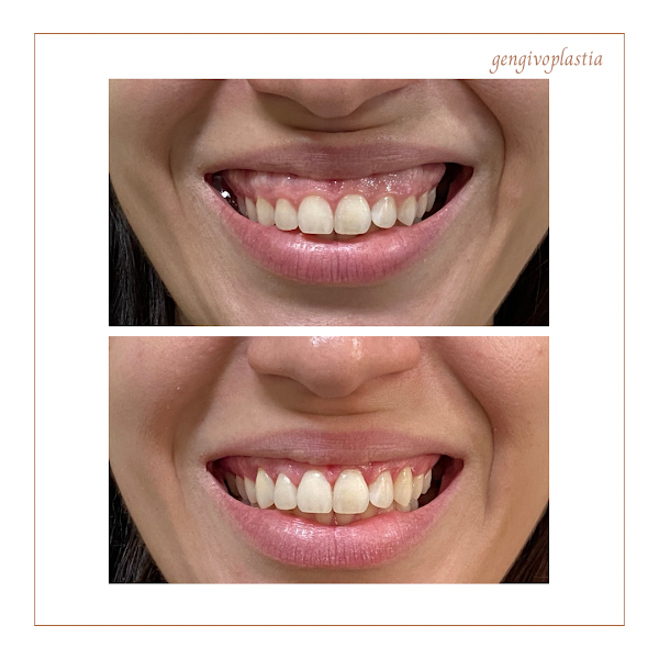 Foto 3 de Dra Adriane Lais - Cirurgiã Dentista