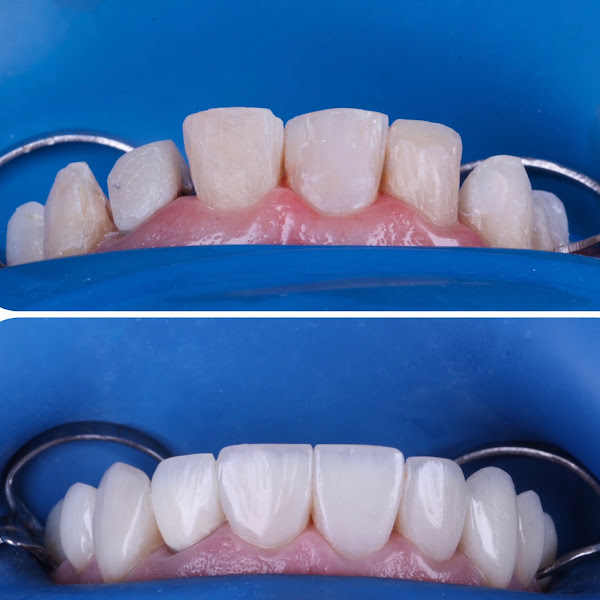 Foto 2 de Dra. Adrieli Mireli - Dentista Porto Velho
