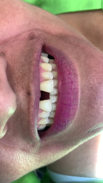 Foto 3 de Dra. Adrielle Késsia - Dentista