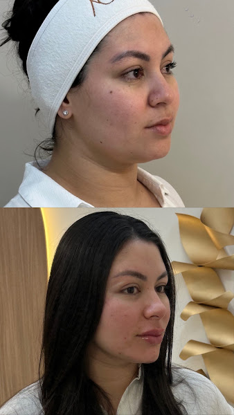 Foto 3 de Dra. Adylla Coimbra | Harmonização Orofacial