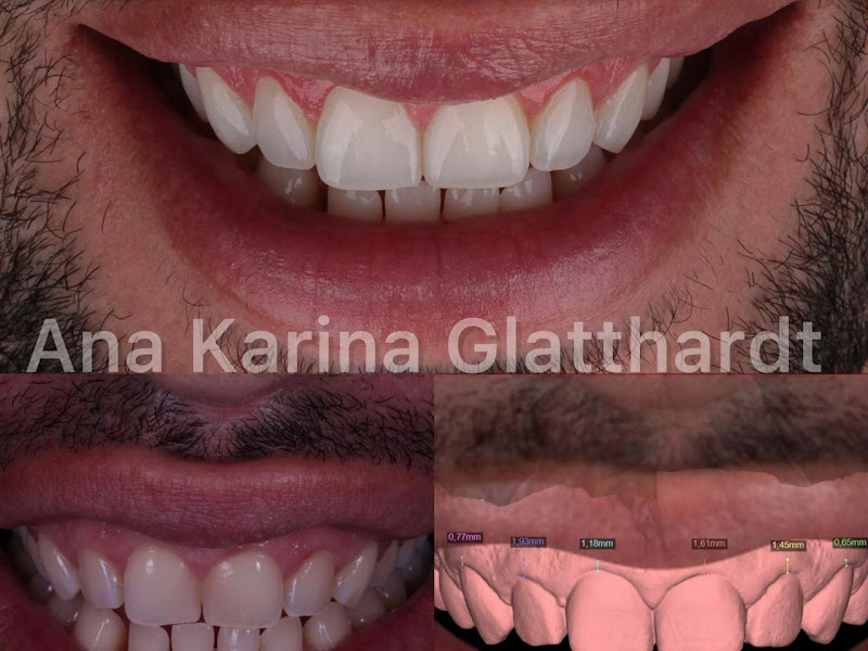 Foto 7 de Dra. Ágatha Claussen - Ortodontia e Odontologia Especializada