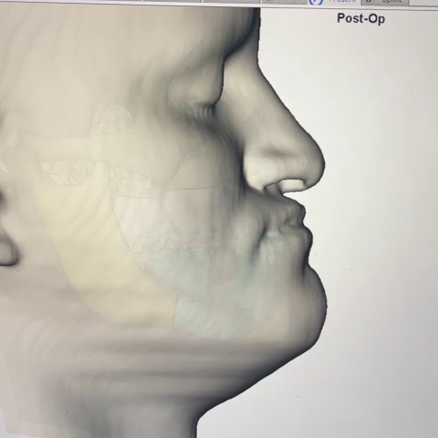 Foto 3 de Dra Ágatha Teixeira (Ortodontia e Clínico Geral)