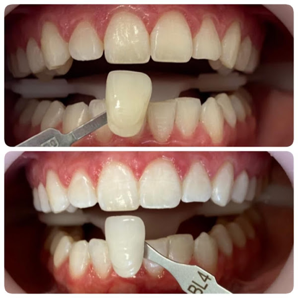 Foto 2 de Dra. Alessandra Datcho, Dentista