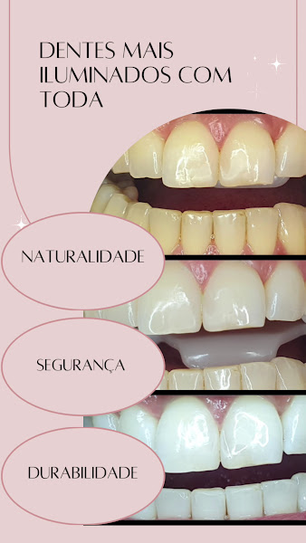 Foto 3 de Dra Alessandra Medeiros Dentista no Rudge Ramos | Horários personalizados | Atendimento Humanizado| Facetas | Clareamento