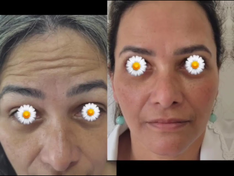 Foto 2 de Dra. Alessandra Nascimento Clínica de Biomedicina Estética Avançada.
