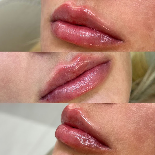 Foto 3 de Dra. Aleteya G. Dias - Odontologia estética | Harmonização facial | implantodontia | dentista.