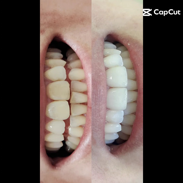 Foto 3 de Dra. Alexandra Steffens | Cirurgiã-dentista - Especialista em Endodontia