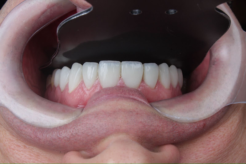 Foto 3 de Dra. Alexia Humburger | Odontologia