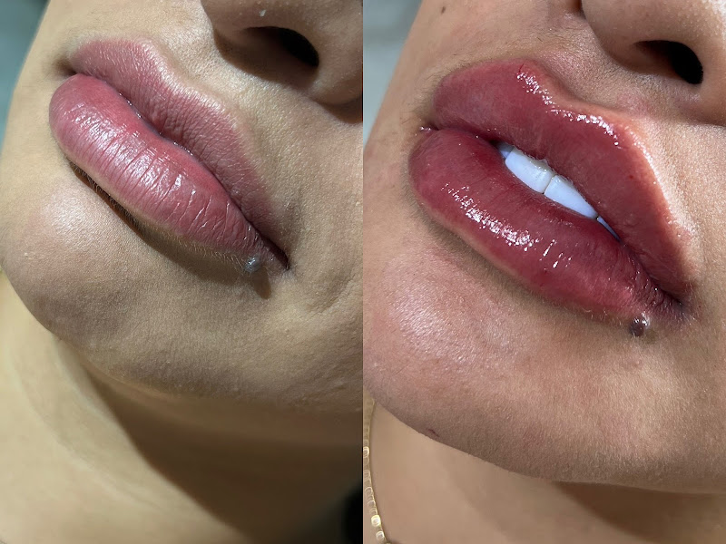 Foto 3 de Dra. Alexia Victoria | Cirurgiã Dentista | Especialista em DTM e Dor Orofacial | Bruxismo, Ronco e Apneia | Botox