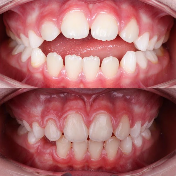 Foto 2 de Dra. Alice Chaves - Dentista